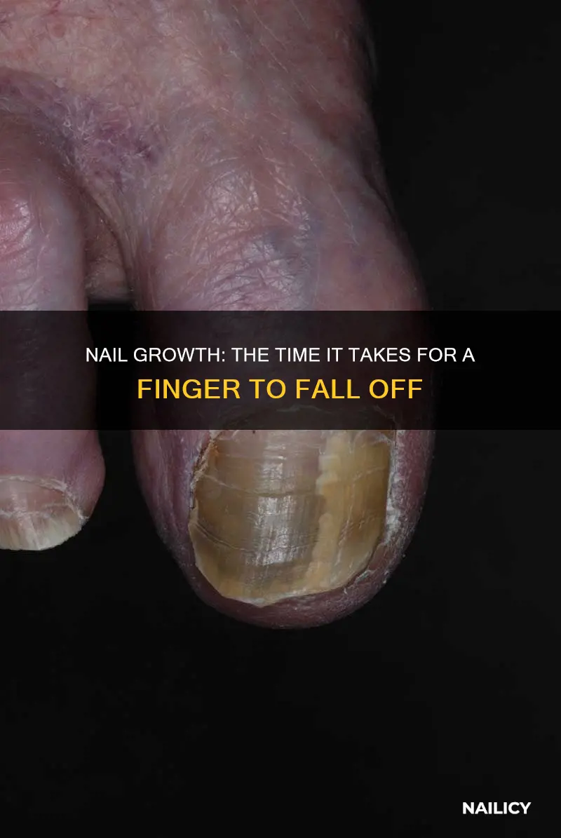 how long does a finger nail take to fall off