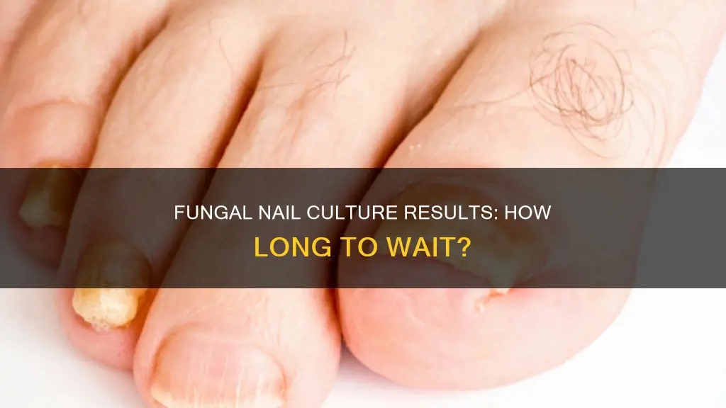 how long does a fungal nail culture take