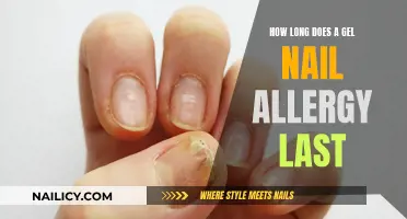 Gel Nail Allergies: How Long Do Reactions Last?