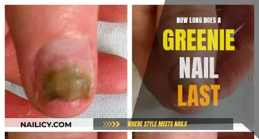 The Longevity of Greenie Nails: How Long Do They Last?