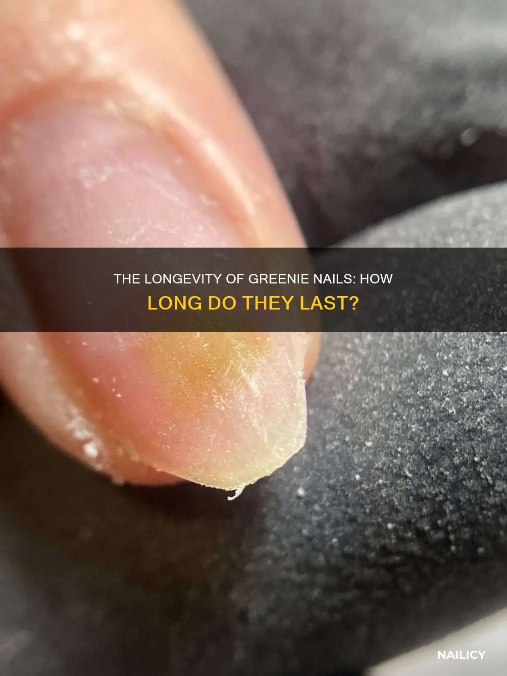 how long does a greenie nail last