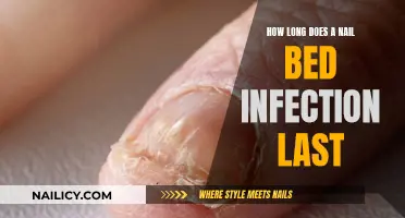 Nail Bed Infection: How Long Does It Last?