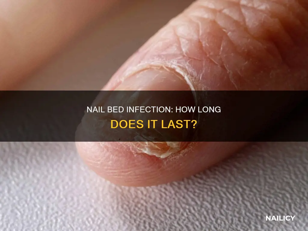 how long does a nail bed infection last