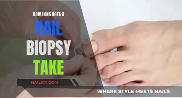 Nail Biopsy: A Quick Procedure for Quick Results