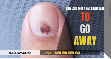 Healing Time for Nail Bruises: How Long?