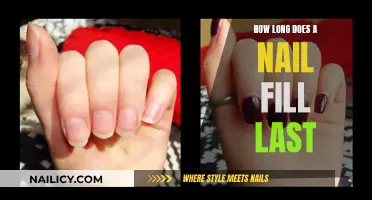 Nail Fill: How Long Does the Effect Last?