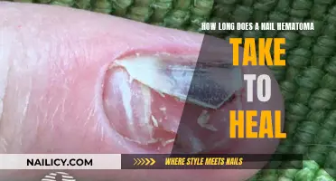 Nail Hematoma: Healing Time and Treatment Options