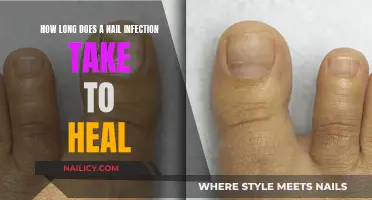 Healing Nail Infections: Time and Treatment Factors