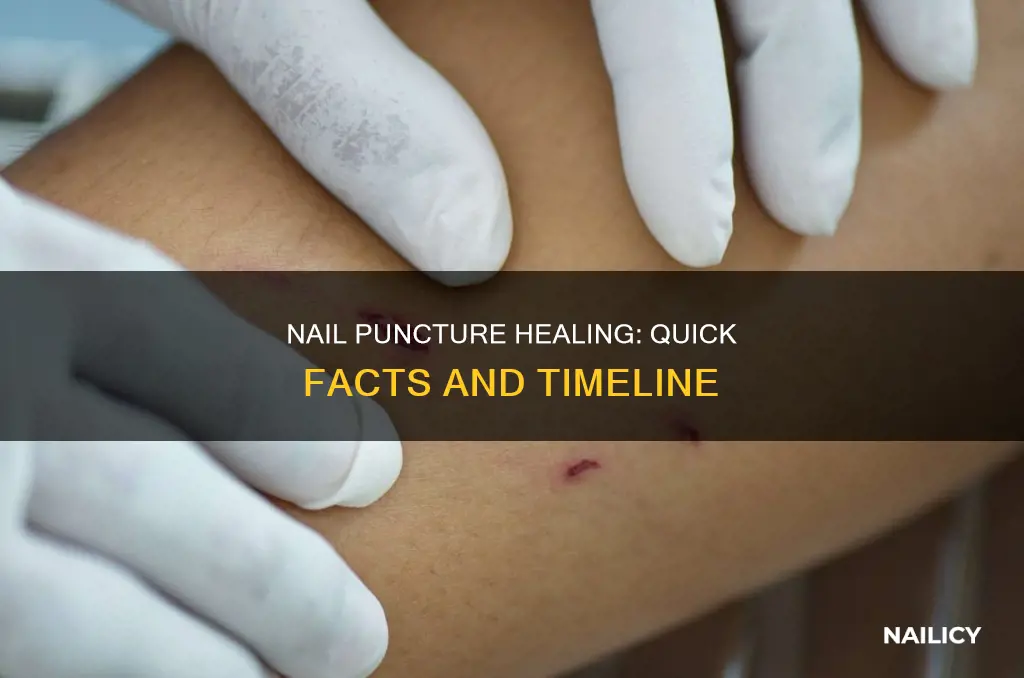 how long does a nail puncture take to heal