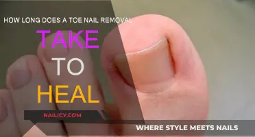 Toe Nail Removal: Healing Time and Aftercare