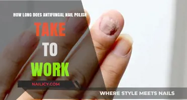 Effective Antifungal Nail Polish: Timelines for Visible Results Explained