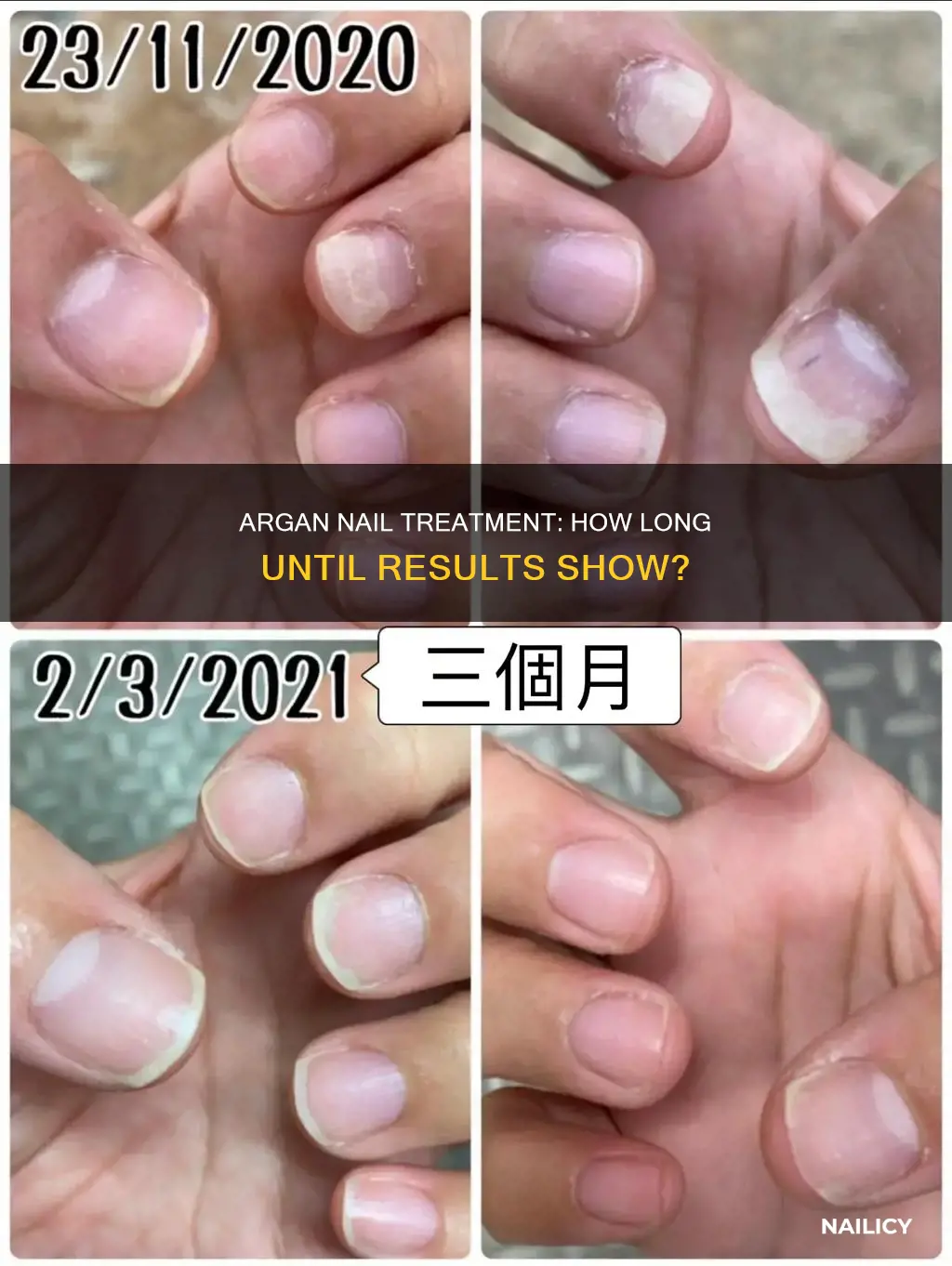 how long does aragan nail treatment take to work