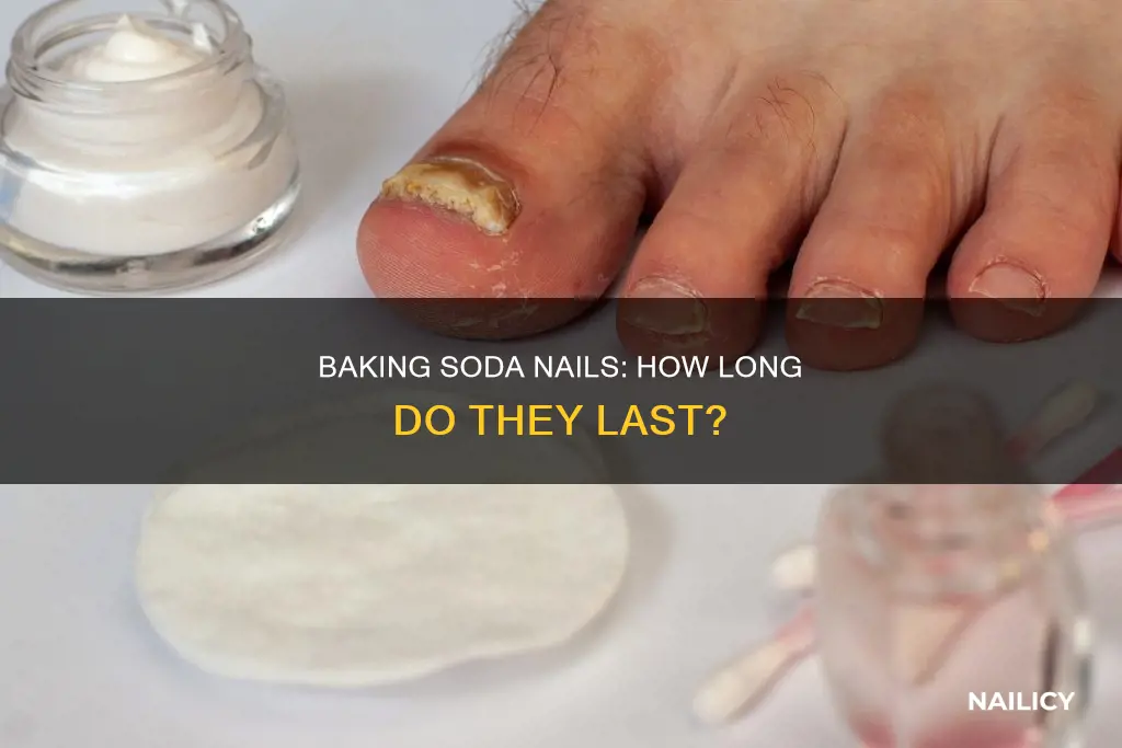 how long does baking soda nails last