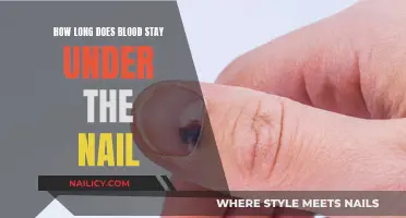 Blood Under Nails: How Long Does It Stay?