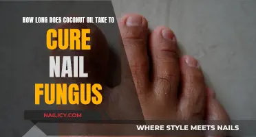 Coconut Oil Treatment for Nail Fungus: How Long Does It Take?