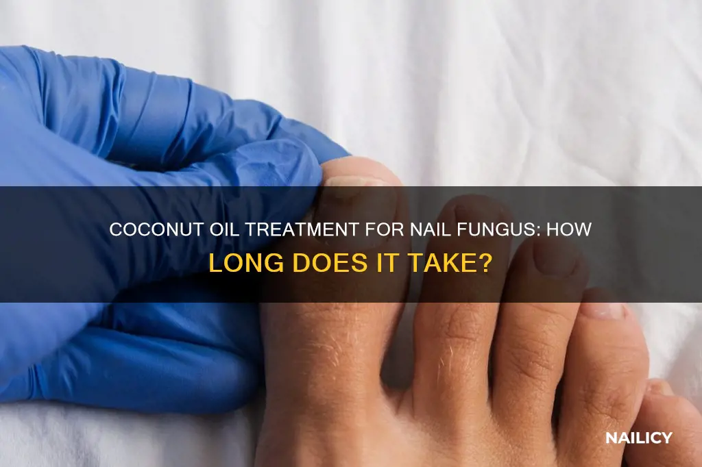 how long does coconut oil take to cure nail fungus