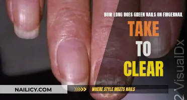 Green Nails: How Long to Recover?