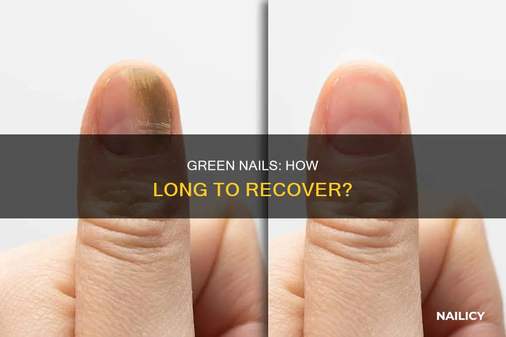 how long does green nails on fingernail take to clear