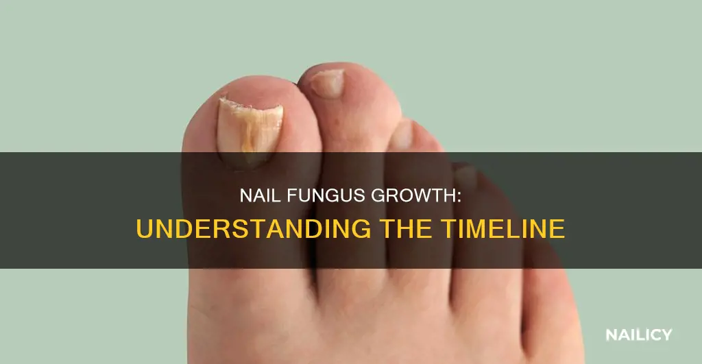 how long does it take finger nail fungus to grow