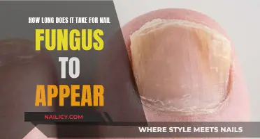 Recognizing Nail Fungus: The Early Signs and Symptoms