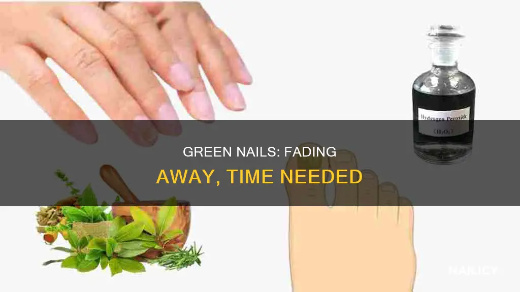 how long does it take green nail to go away
