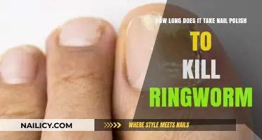 Nail Polish and Ringworm: Debunking Myths and Understanding Treatment Times