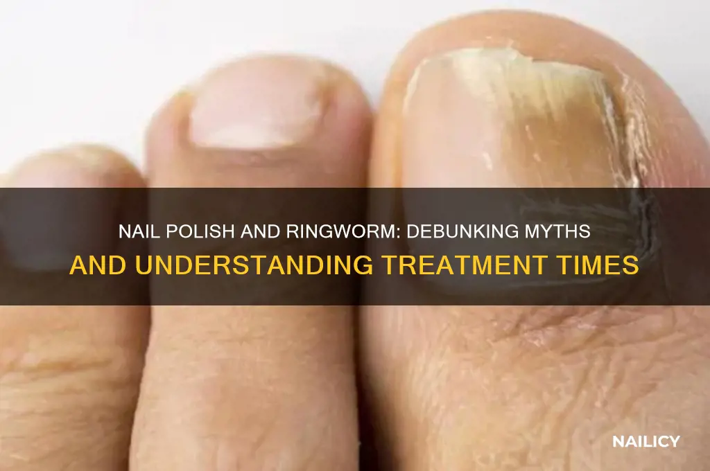 how long does it take nail polish to kill ringworm