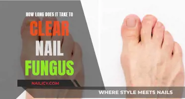 Eradicating Nail Fungus: A Long-Term Battle