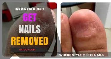 The Ultimate Guide to Safe and Speedy Nail Removal