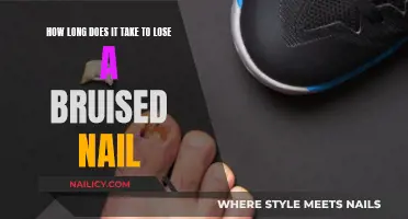 Healing Time for Bruised Nails: How Long?