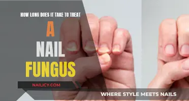 Effective Treatment for Nail Fungus: How Long Does It Take?
