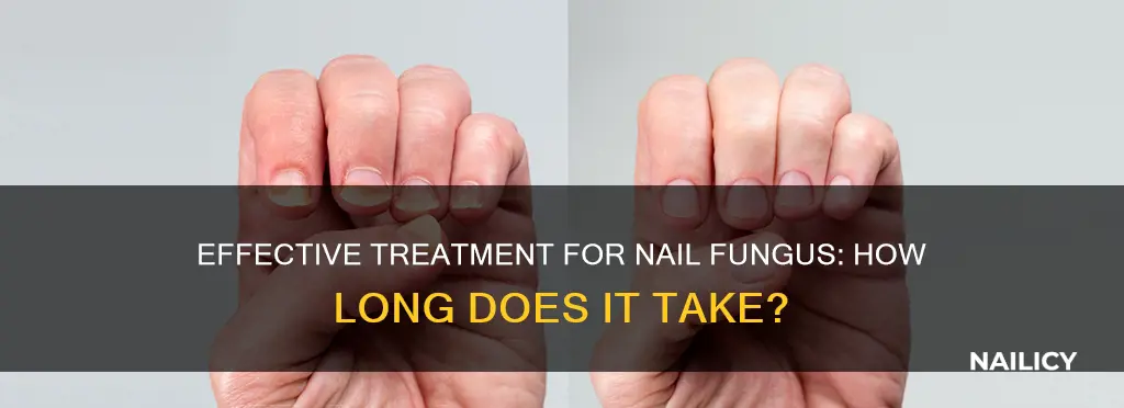 how long does it take to treat a nail fungus