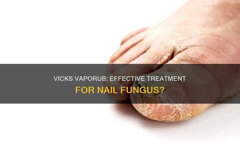 how long does it take vicks to cure nail fungus