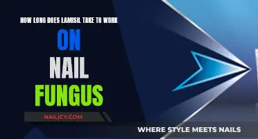 Lamisil Treatment: How Long to Cure Nail Fungus?