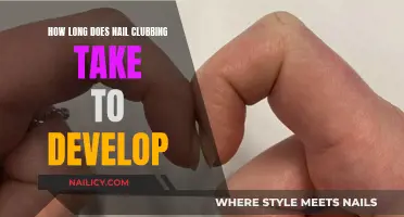 Nail Clubbing: Understanding Development Time and Causes