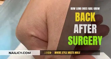 Regrowing Nails: Recovery Time After Surgery