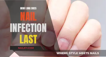 Battling Nail Infection: How Long Does It Last?