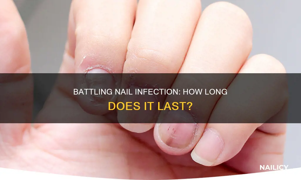how long does nail infection last