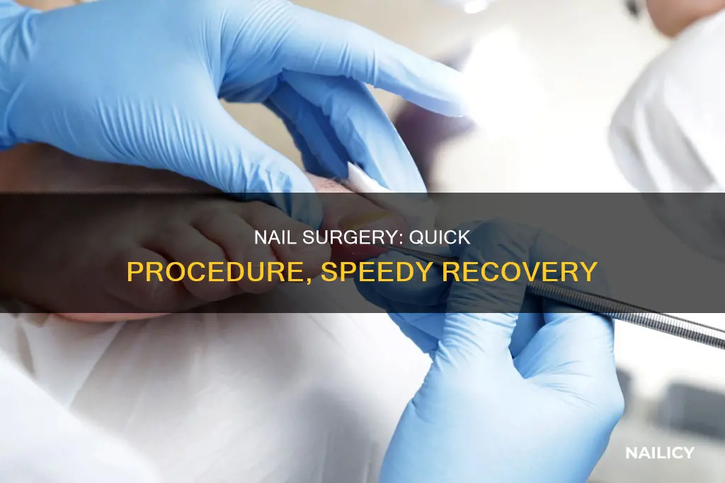 how long does nail surgery take