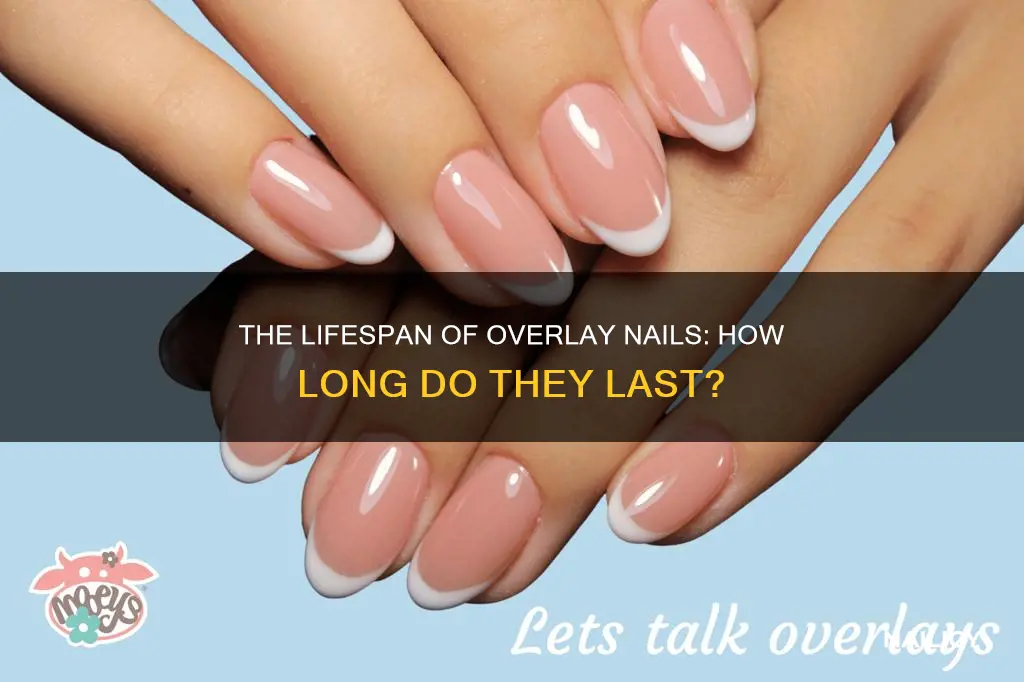 how long does overlay nails last