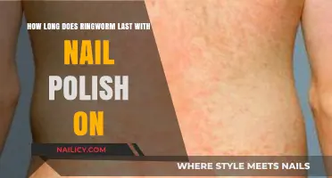 Ringworm Duration: Does Nail Polish Affect Healing Time?