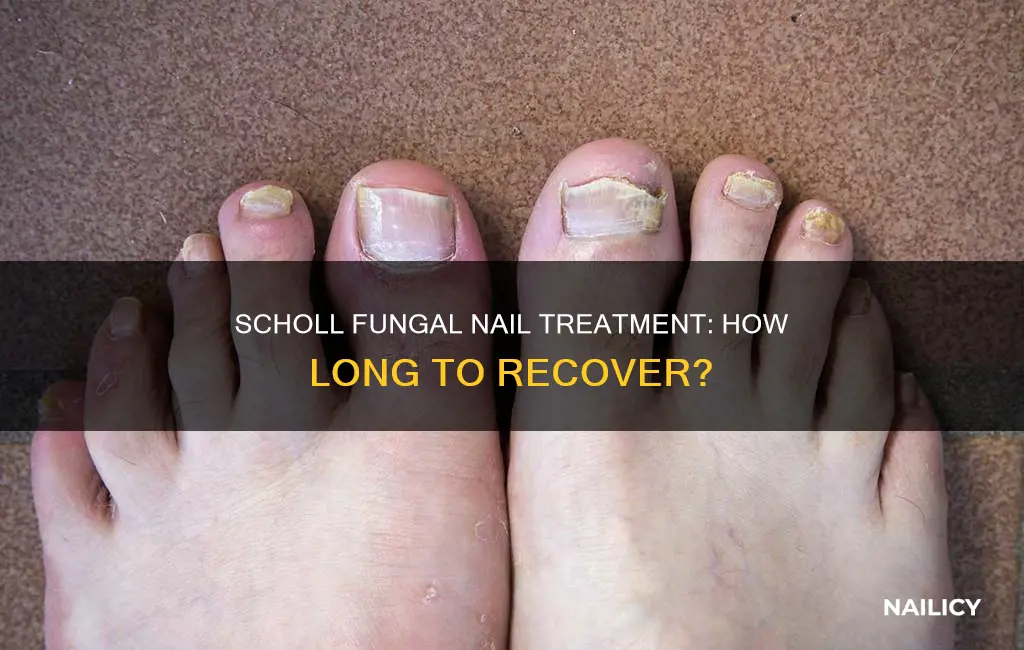 how long does scholl fungal nail treatment take to work