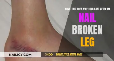 Healing a Broken Leg: Understanding Post-Injury Swelling