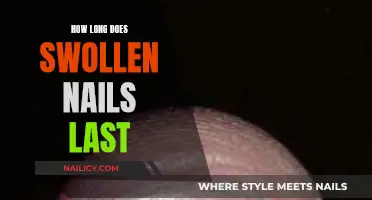 Swollen Nails: How Long Does the Pain Last?