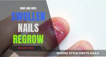 Swollen Nails: Time to Heal and Regrow