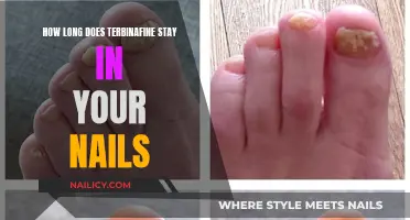 Terbinafine Treatment: How Long in Nails?