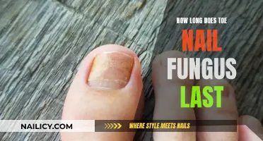 Toe Nail Fungus: How Long Does It Last?