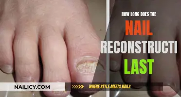 Toe Nail Reconstruction: How Long Does It Last?