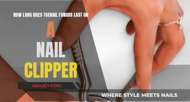 Toenail Fungus: Nail Clippers and Infection Risks