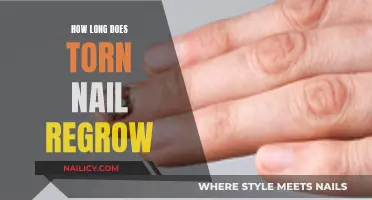 Healing Time: Torn Nail Regrowth